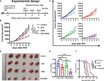 Combination of Radiofrequency Ablation With Resiquimod to Treat Hepatocellular Carcinoma Via Inflammation of Tumor Immune Microenvironment and Suppression of Angiogenesis